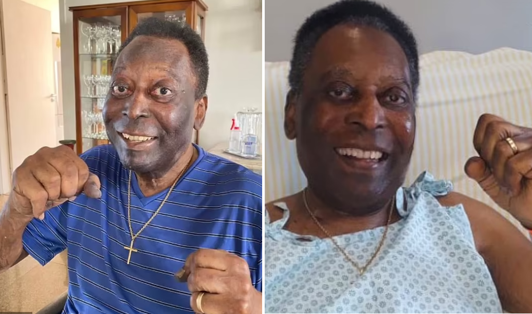 Brazil Legend Pele Shows ‘Progressive Improvement’ In Hospital Brazil Legend Pele Shows ‘Progressive Improvement’ In Hospital